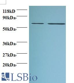 Western blot of D-3-phosphoglycerate dehydrogenase antibody at 2 ug/ml. Lane 1: EC109 whole cell lysate. Lane 2: 293T whole cell lysate. Secondary: Goat polyclonal to Rabbit IgG at 1:15000 dilution. Predicted band size: 59 kDa. Observed band size: 59 kDa.