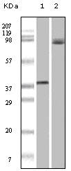 Western blot analysis using BRAF (1F12) Antibody (Cat. No. 252640) against truncated recombinant Braf (1) and A431 cell lysate (2).