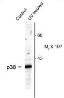 The p38 MAPK (Thr180/Tyr182) Antibody is used in Western blot to detect p38 MAPK phosphorylated at Thr180/Tyr182 in HeLa cell lysates untreated (left lane) or UV-irradiated (right lane).