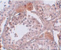 Immunohistochemistry of CLPH in human testis tissue with CLPH Antibody (Cat. No. 254179) at 5 ug/mL.