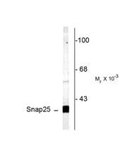 The SNAP25 Antibody (Cat. No. 253216) is used in Western blot to detect SNAP25 in rat cortex tissue lysates.