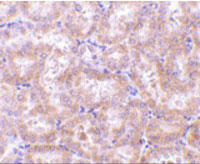 Immunohistochemistry of RIP3 in rat kidney tissue with RIP3 Antibody (Cat. No. 253368) at 5 ug/ml.