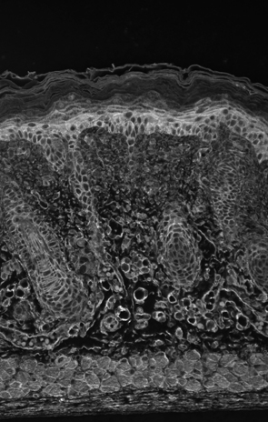 IHC analysis of HIF1Alpha tested on mouse backskin sections.