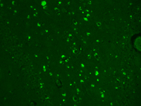 IF analysis of TrpC4 in human hippocampal tissue using SMC-315.