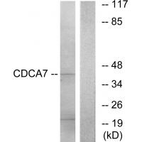 Western blot analysis of extracts from K562 cells, using CDCA7 antibody #34194.