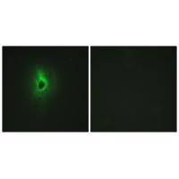 Immunofluorescence analysis of HeLa cells, using Collagen VI α3 antibody #34209.