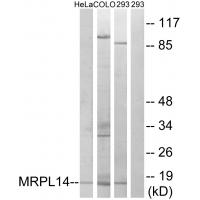 Western blot analysis of extracts from HeLa cells, COLO cells and 293 cells, using MRPL14 antibody #34318.