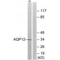 Western blot analysis of extracts from Jurkat cells, using AQP12 antibody #34435.