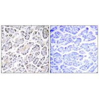 Immunohistochemistry analysis of paraffin-embedded human pancreas tissue using ATP5G3 antibody #34451.