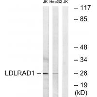 Western blot analysis of extracts from Jurkat cells and HepG2 cells, using LDLRAD1 antibody #34763.