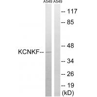 Western blot analysis of extracts from A549 cells, using KCNK15 antibody #34912.