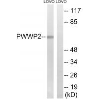 Western blot analysis of extracts from LOVO cells, using PWWP2B antibody #34941.