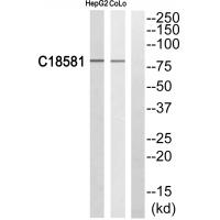Western blot analysis of extracts from HepG2 cells and COLO205 cells, using NEK5 antibody #35021.