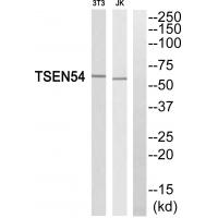 Western blot analysis of extracts from 3T3 cells and Jurkat cells, using TSEN54 antibody #35110.