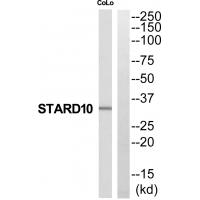 Western blot analysis of extracts from COLO205 cells, using STARD10 antibody #35208.
