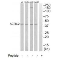 Western blot analysis of extracts from HepG2, HuvEc, Jurkat and A549 cells, using ACTBL2 antibody #35303.