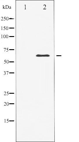 Western blot analysis of Elk1 expression in heatshock treated HeLa whole cell lysates,The lane on the left is treated with the antigen-specific peptide.