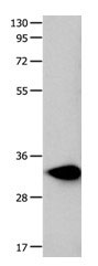 Gel: 10%+12%SDS-PAGE Lysate: 40 µg Mouse heart tissue lysate Primary antibody: 1/250 dilution Secondary antibody: Goat anti Rabbit IgG - H&L (HRP) at 1/10000 dilution Exposure time: 10 seconds