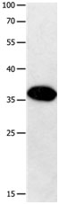 Gel: 10%SDS-PAGE Lysate: 40 µg Human small intestine stromal tumors tissue lysate  Primary antibody: 1/200 dilution Secondary antibody: Goat anti Rabbit IgG - H&L (HRP) at 1/10000 dilution Exposure time: 30 seconds 