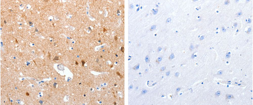 The image on the left is immunohistochemistry of paraffin-embedded Human brain tissue using 31210 (GPR6 Antibody) at dilution 1/10, on the right is treated with the synthetic peptide.