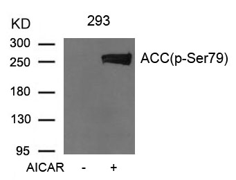 Western blot analysis of extracts from 293 cells untreated or treated with AICAR using Acetyl-CoA Carboxylase (Phospho-Ser79) Antibody #11584.