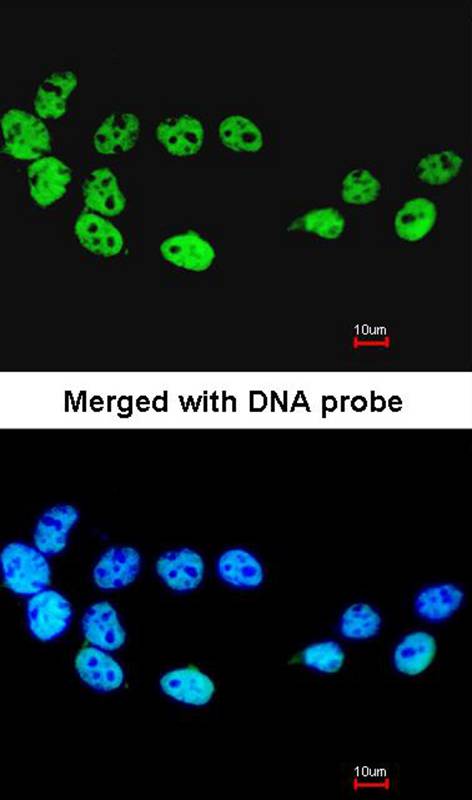 Immunofluorescence analysis of paraformaldehyde-fixed A431, using CDC26 antibody at 1: 200 dilution.