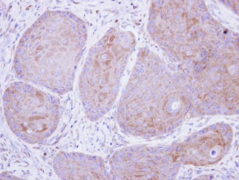 Immunohistochemical analysis of paraffin-embedded Cal27 xenograft, using POMGNT1 antibody at 1: 500 dilution.
