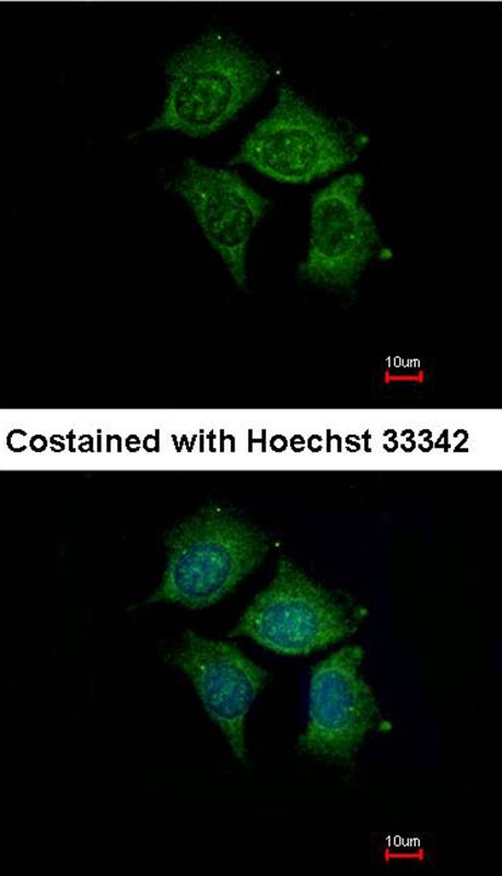 Immunofluorescence analysis of methanol-fixed Hep3B, using POMGNT1 antibody at 1: 500 dilution.