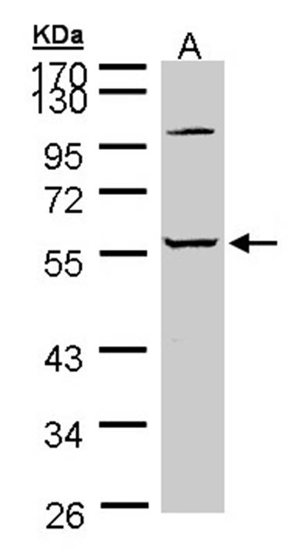 Sample (30 ug of whole cell lysate)A: A431 10 % SDS PAGEPrimary antibody diluted at 1: 5000