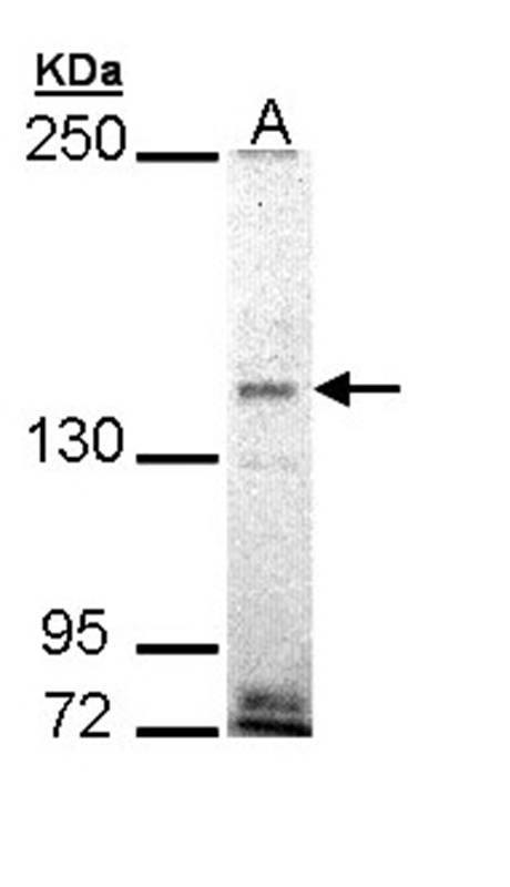 Sample (30 ug of whole cell lysate) A: H1299 5% SDS PAGE Primary antibody diluted at 1: 1000