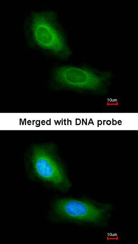 Immunofluorescence analysis of paraformaldehyde-fixed HeLa, using CCDC68 antibody at 1: 200 dilution.