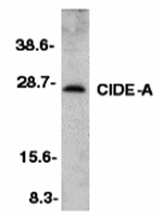 Western blot analysis of CIDE-A in mouse heart tissue lysate with CIDE-A antibody at 1:500 dilution.
