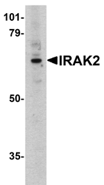 Western blot analysis of IRAK2 in K562 whole cell lysate with IRAK2 antibody at 1:500 dilution. 