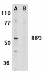 Western blot analysis of RIP3 in mouse 3T3 whole cell lysate in the absence (A) or presence (B) of blocking peptide with RIP3 antibody at 1 ug/mL. 