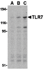 Western blot analysis of TLR7 in Daudi cell lysates with TLR7 antibody at (A) 0.5, (B) 1, and (C) 2 ug/mL.