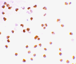 Immunocytochemistry staining of Daudi cells using TLR7 antibody at 2 ug/mL.