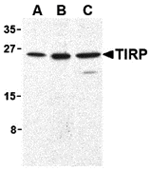 Western blot analysis of TIRP in human (A), mouse (B), and rat (C) kidney cell lysates with TIRP antibody (C2) at 1 ug/mL.