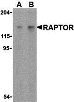 Western blot analysis of Raptor in L1210 cell lysate with Raptor antibody at (A) 2 and (B) 4 ug/mL.