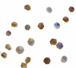 Immunocytochemistry of IRAK2 in A-20 cells with IRAK2 antibody at 1 ug/mL.