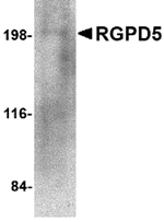 Western blot analysis of RGPD5 in human thymus tissue lysate with RGPD5 antibody at 1 ug/mL.