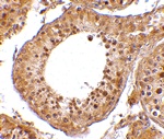 Immunohistochemistry of RGPD5 in human testis tissue cells with RGPD5 antibody at 10 ug/mL.