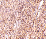 Immunohistochemistry of TRIM30 in mouse ovary tissue with TRIM30 antibody at 10 ug/mL.