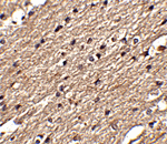 Immunohistochemistry of Spred3 in human brain tissue with Spred3 antibody at 2.5 ug/mL.