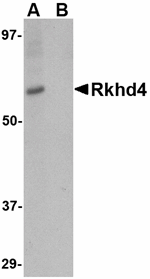 Western blot analysis of Rkhd4 in SK-N-SH cell lysate with Rkhd4 antibody at 1 ug/mL in (A) the absence and (B) the presence of blocking peptide.