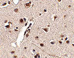 Immunohistochemistry of Rkhd4 in human brain tissue with Rkhd4 antibody at 2.5 ug/mL.