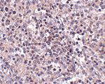 Immunohistochemistry of ZIP10 in human spleen tissue with ZIP10 antibody at 2.5 ug/mL.