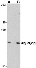 Western blot analysis of SPG11 in mouse heart tissue lysate with SPG11 antibody at (A) 0.5 and (B) 1 ug/mL.