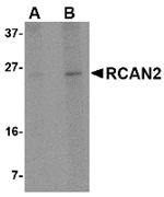 Western blot analysis of RCAN2 in 3T3 cell lysate with RCAN2 antibody at (A) 1 and (B) 2 ug/mL.
