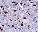 Immunohistochemistry of RCAN2 in mouse brain tissue with RCAN2 antibody at 2.5 ug/mL.