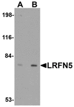 Western blot analysis of LRFN5 in EL4 cell lysate with LRFN5 antibody at (A) 0.5 and (B) 1 ug/mL.